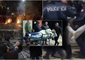 I thyen këmbën 19-vjeçarit, pezullohen 4 policët! Hetim disiplinor ndaj shefit të komisariatit nr.1