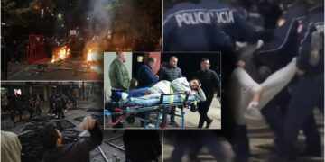 I thyen këmbën 19-vjeçarit, pezullohen 4 policët! Hetim disiplinor ndaj shefit të komisariatit nr.1