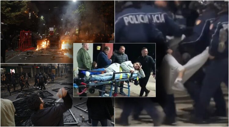 I thyen këmbën 19-vjeçarit, pezullohen 4 policët! Hetim disiplinor ndaj shefit të komisariatit nr.1