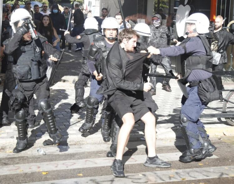 Dhuna në protestën studentore/ Ministria e Shëndetësisë: 6 persona në spital, njëri prej tyre po i nënshtrohet ndërhyrjes kirurgjikale