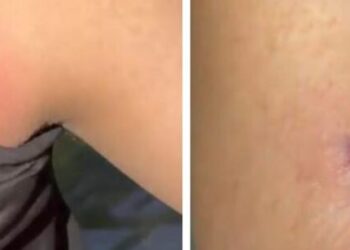 Sjellje çnjerëzore, i riu qëllohet nga Policia me 7 plumba gome në trup