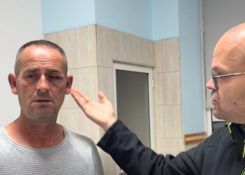 Po shkonte në shtëpi me bukë me vete, dhunohet qytetari nga 2 efektivë të FNSH-së, përfundon te Trauma me fraktura