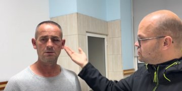 Po shkonte në shtëpi me bukë me vete, dhunohet qytetari nga 2 efektivë të FNSH-së, përfundon te Trauma me fraktura