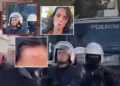 “Më gjuajti me shkop gome…”/ Studentja: Si u dhunova papritur nga polici i FNSH