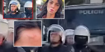 “Më gjuajti me shkop gome…”/ Studentja: Si u dhunova papritur nga polici i FNSH