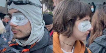 Protestuesit solidarizohen me plagosjen e Erion Vishkullit, vendosin në mënyrë simbolike fasho në syrin e majtë