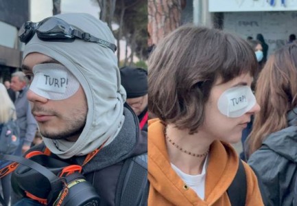 Protestuesit solidarizohen me plagosjen e Erion Vishkullit, vendosin në mënyrë simbolike fasho në syrin e majtë
