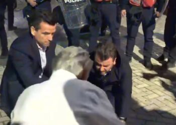 Erald Kapri publikon pamjet e sulmit me spraj, deputeti paralajmëron kallëzim në SPAK ndaj Skënder Hitajt