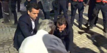 Erald Kapri publikon pamjet e sulmit me spraj, deputeti paralajmëron kallëzim në SPAK ndaj Skënder Hitajt
