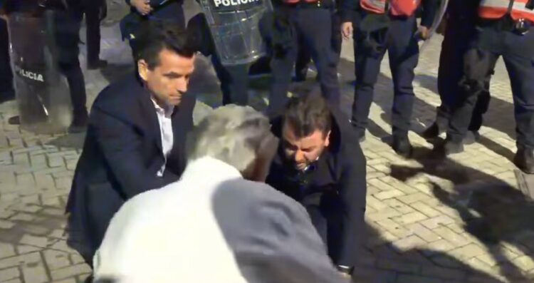 Erald Kapri publikon pamjet e sulmit me spraj, deputeti paralajmëron kallëzim në SPAK ndaj Skënder Hitajt