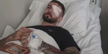 “Plumbin e kam ende në sy”/ Flet Erjon Vishkulli që u plagos në protestë: Isha 30 metra larg efektivëve…