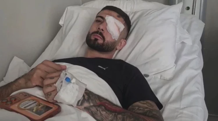 “Plumbin e kam ende në sy”/ Flet Erjon Vishkulli që u plagos në protestë: Isha 30 metra larg efektivëve…